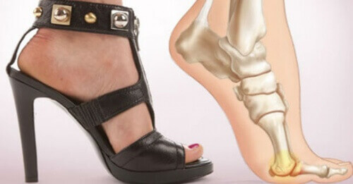 5 fordeler du får når du slutter å bruke høyhælte sko