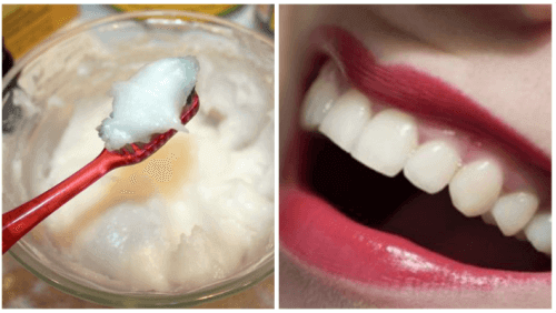 Kokosolje for munnhelsen: Bli kvitt orale helseproblemer