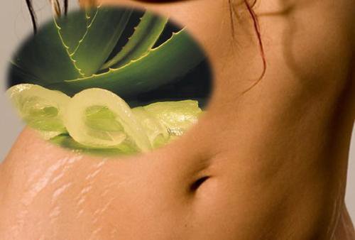 6 naturlige remedier for å redusere strekkmerker