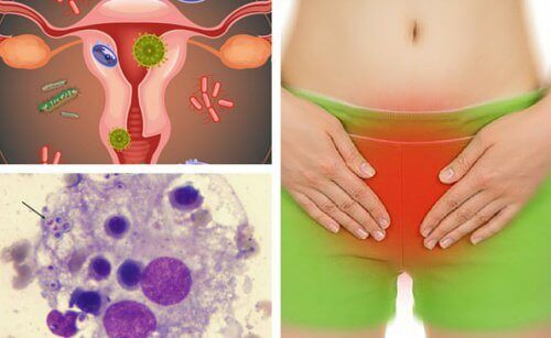 7 tips for lindring av vaginale infeksjoner 7 tips for lindring av vaginale infeksjoner