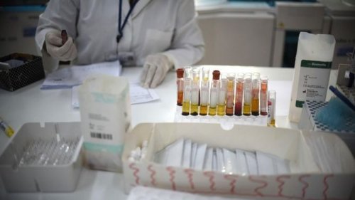 Tilfeller av hemoragisk krim-kongofeber har blitt funnet i Spania