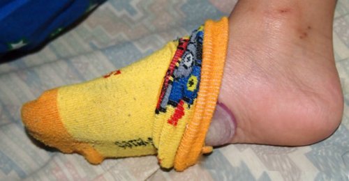 4 fordeler med å sove med løk på føttene