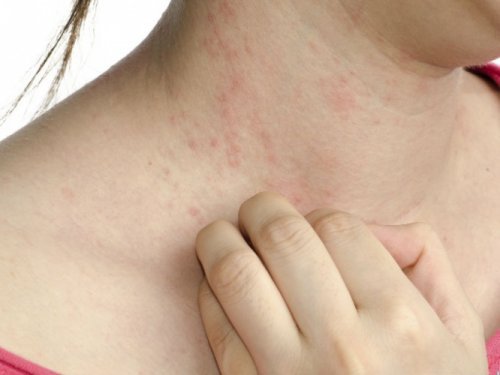 5 lite kjente symptomer på diabetes