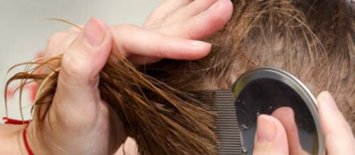 7 naturlige måter å bli kvitt hodelus på