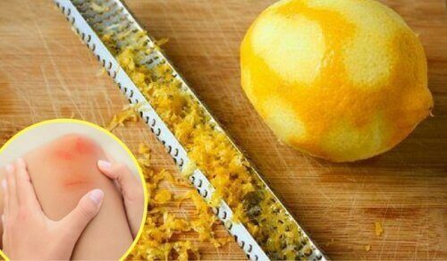 Bruk av sitronskall for behandling av leddsmerter