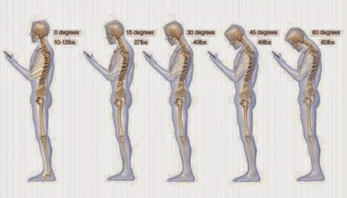 6 vaner som forårsaker nakkesmerter