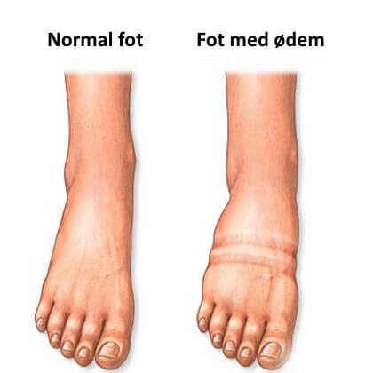 2-vaeskeansamling