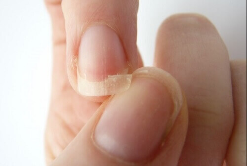 9 grunner til at neglene dine brekker