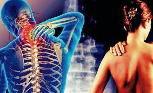 Cervikobrakialt syndrom: smerte fra nakken til armene