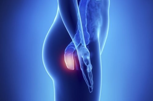 5 symptomer på analkreft du bør vite om