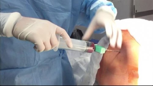 bli en benmargsdonor