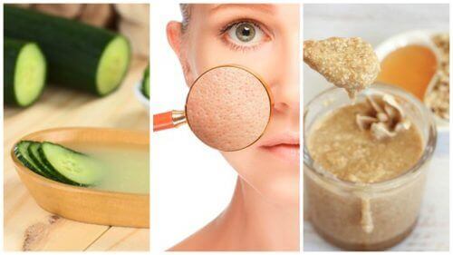 Du kan krympe porene dine med disse 5 naturlige behandlingene