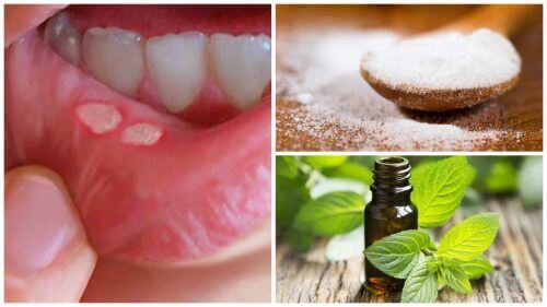 7 hjemmebehandlinger for å bli kvitt munnsår raskere