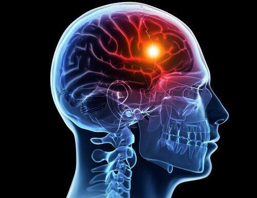 8 av kroppens varsler i forkant av et hjerneslag