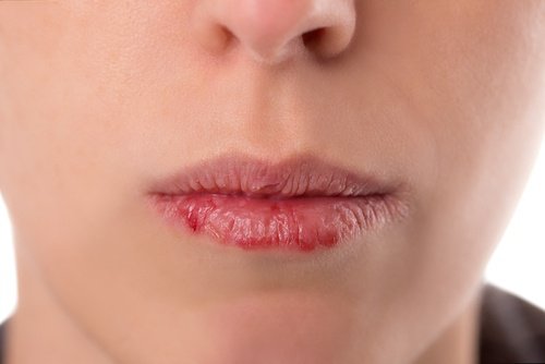 Symptomer på munnsvelgkreft som du bør kunne