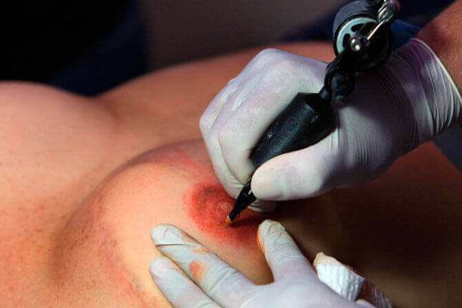 Artister gjenoppretter overlevende fra brystkreft sin femininitet