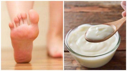 Hjemmelaget behandling med eddik og yoghurt for å fjerne træler på føttene