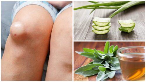 De 5 beste behandlingene for å redusere hevelse i knær