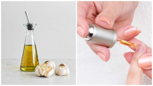 Styrk neglene dine med en lotion av hvitløk og olje