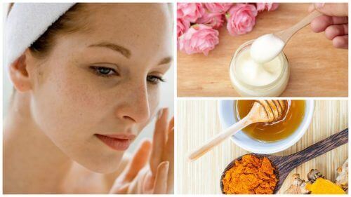 5 kremer som reduserer pigmentflekker i ansiktet