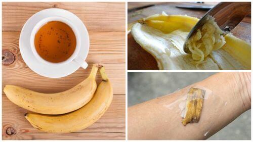 5 måter å bruke bananskall på