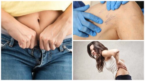 9 problemer du kan ha hvis du bruker stramme klær