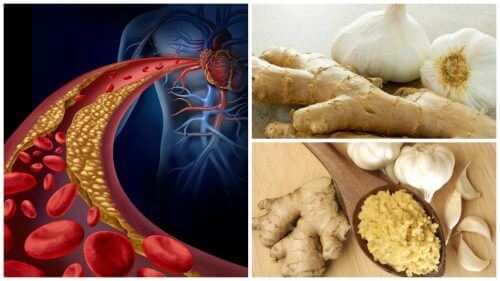 Bekjemp høyt blodtrykk og kolesterol med ingefær og hvitløk