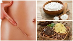 De 7 beste naturlige behandlingene for å redusere arr