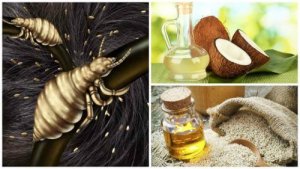 Bli kvitt lus med disse 5 hjemmemebehandlingene