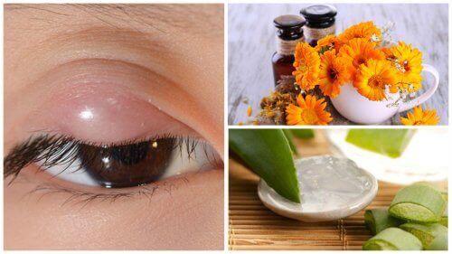 Lindre sti på øyet med disse 7 naturlige behandlingene
