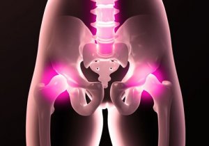 6 gode tips for å forhindre hoftesmerter