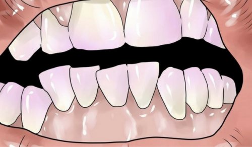 Bli kvitt plakk på tennene på en naturlig måte