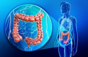 Crohns sykdom: Hva er det og hvordan behandles det?
