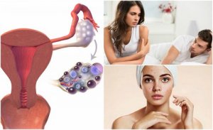 7 symptomer på polycystisk ovariesyndrom