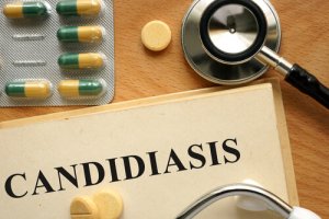 Veiledning og behandling av candidiasis
