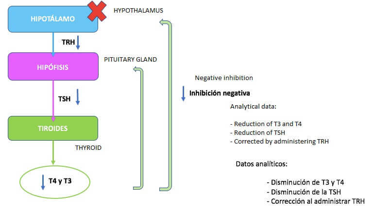 Tertiær hypotyreose