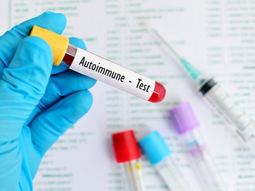 Autoimmun-test