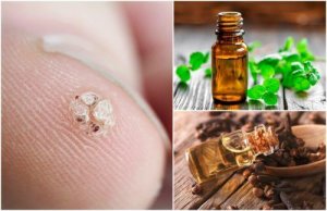 7 eteriske oljer som vil hjelpe deg med å bli kvitt vorter