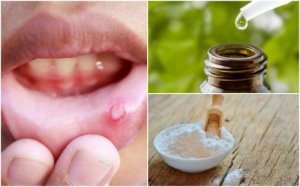 Få lindring fra after med disse 6 naturlige midlene