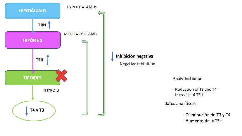 Primær hypotyreose