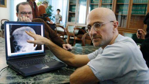 Sergio Canaveros snakker om hodetransplantasjon