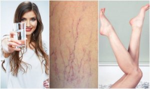 Les disse 6 tipsene hvis du vil forhindre åreknuter