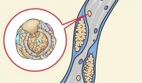 5 matvarer for å rense arteriene dine på den naturlige måten 5 matvarer for å rense arteriene dine på den naturlige måten