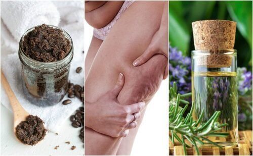 5 utrolige naturlige remedier for å redusere cellulitter: Prøv dem! 5 utrolige naturlige remedier for å redusere cellulitter: Prøv dem!
