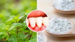 5 effektive hjemmebehandlinger for gingivitt