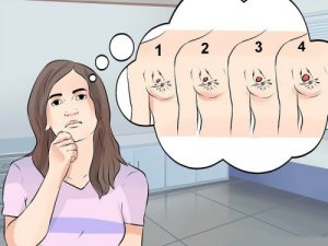 Brystkreft: De ulike typene, symptomene og behandlingene