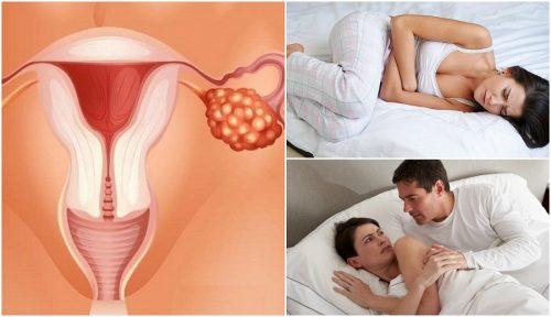 7 symptomer på eggstokkreft som enhver kvinne bør vite om