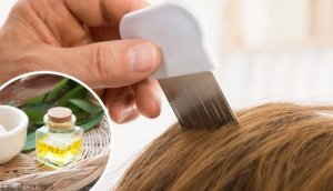 6 hjemmeremedier for å eliminere lus