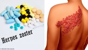 Diagnosefakta og symptomer på helvetesild