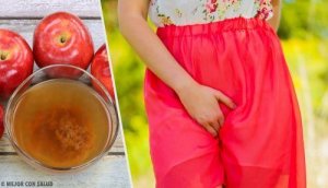 Remedier mot svie og kløe i underlivet